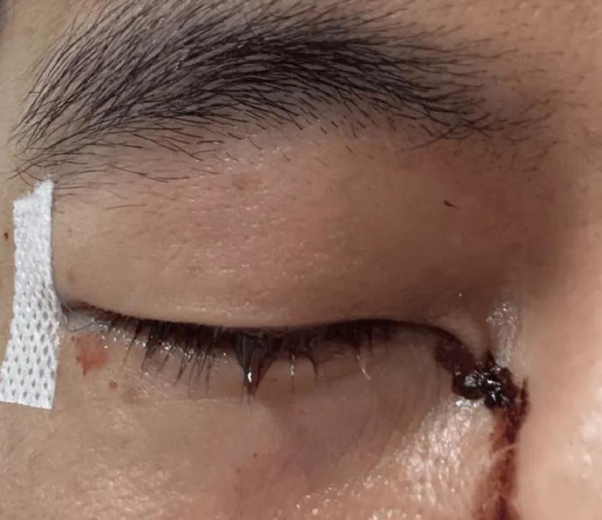 队员伤情紧急!球队备受压力的简单介绍 队员伤情紧急!球队备受压力的简单介绍